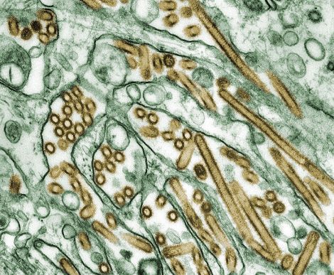 The H5N1 virus, shown in gold. Photo: Centers for Disease Control and Prevention