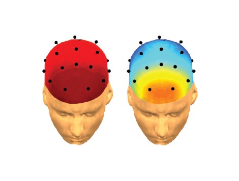 A younger brain (left) has a stronger presence of slow brain waves. Slow brain waves begin to diminish as we grow older (right). mage: Bryce Mander/Univeristy of California, Berkeley