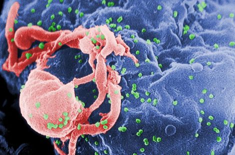  Scanning electron micrograph of HIV-1 budding (in green) from cultured lymphocyte. Photo: CDC